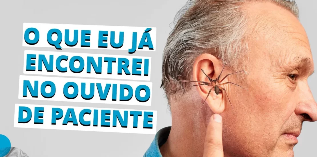 aranha barata inseto no ouvido cera cerume lavagem de ouvido, tirar cera otorrino em Curitiba otorrinolaringologista Hospital IPO