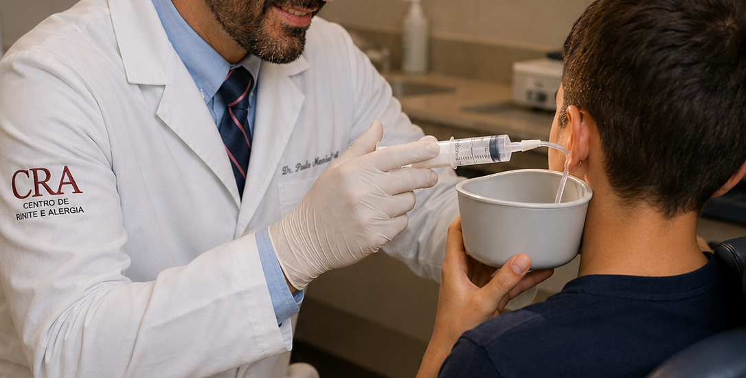 LIMPEZA DE OUVIDO E REMOÇÃO DE CERA: QUANDO A LAVAGEM DE OUVIDO É NECESSÁRIA, O QUE NÃO FAZER EM CASA E QUANDO PROCURAR UM OTORRINO Um guia completo sobre cerume, ouvido tampado, cotonete, lavagem de ouvido, remédios para amolecer a cera e quando fazer limpeza com otorrinolaringologista Por Dr. Paulo Mendes Jr. | Médico Otorrinolaringologista em Curitiba Centro de Rinite do Hospital IPO [INSERIR VÍDEO NO TOPO DA PÁGINA] Sugestão de vídeo no início do artigo: “Muita gente sente o ouvido tampado, a audição abafada ou a sensação de pressão e logo pensa que precisa ‘limpar a cera’. O problema é que a maioria tenta resolver isso do jeito errado: usando cotonete, dedo, chave, tampa de caneta, grampo ou outras manobras caseiras que empurram a cera para dentro e aumentam o risco de lesão. Neste texto eu vou te explicar quando a cera do ouvido é normal, quando ela vira problema, quando pode ser necessário usar gotas para amolecer o cerume e em quais casos a limpeza deve ser feita pelo otorrino — seja com lavagem de ouvido ou com remoção a seco.” Se o seu ouvido vive tampando, coçando, abafando a audição ou “enche de cera”, este texto é para você Pouca coisa assusta tanto quanto a sensação de que o ouvido fechou de repente. Às vezes começa com uma impressão leve de abafamento. Em outras situações, a pessoa sai do banho, usa cotonete, coloca um fone intra-auricular ou deita de lado e, de repente, sente que a audição caiu, como se estivesse “dentro d’água”, “dentro de uma piscina” ou “com algodão no ouvido”. A partir daí, muitos pacientes entram num ciclo clássico: tentam “limpar melhor” com cotonete enfiam o dedo usam chave, tampa de caneta, presilha ou clips pingam produtos sem orientação fazem lavagem em casa sem saber se aquilo é realmente cera insistem em mexer no ouvido porque sentem coceira ou entupimento E o que era um acúmulo de cerume relativamente simples pode virar um problema muito mais incômodo: cera impactada, dor, irritação do canal, machucado, inflamação, piora da audição e até perfuração do tímpano em casos mais graves. O ponto central que eu quero deixar claro desde o começo é este: a cera do ouvido não é sujeira. Ela tem função. E o excesso de “limpeza” é justamente uma das causas mais comuns de problema. Sim, a cera pode acumular demais e bloquear o ouvido. Sim, em algumas pessoas ela precisa ser removida por um otorrinolaringologista. Sim, há pacientes que precisam de lavagem de ouvido ou de remoção de cerume a seco, às vezes no mesmo dia da consulta. Mas isso é completamente diferente de transformar o ouvido em um lugar de “manutenção caseira” com cotonete e objetos improvisados. Neste artigo, eu vou te mostrar de forma detalhada: para que serve a cera do ouvido por que usar cotonete costuma piorar quais sintomas o acúmulo de cerume pode causar quando a cera deve ser tratada e quando não precisa mexer quando pode ser necessário usar gotas para amolecer o cerume quando a limpeza pode ser feita com lavagem de ouvido quando o melhor é fazer a remoção a seco no consultório por que em alguns casos não se deve lavar o ouvido quando a pessoa precisa de consulta antes de qualquer tentativa de limpeza por que alguns pacientes se beneficiam de uma revisão anual com otorrino como funciona o atendimento comigo em Curitiba, inclusive para pacientes particulares, Unimed e SINAM A cera do ouvido é importante. O problema não é ter cera — é ter cera demais, cera impactada ou tentar tirar do jeito errado Vamos começar do ponto mais importante: cerume é normal. A cera do ouvido — chamada tecnicamente de cerume — é uma substância produzida na parte mais externa do canal auditivo. Ela é formada por secreções das glândulas do ouvido, células descamadas da pele e outras partículas. E ela não está ali por acaso. Para que serve a cera do ouvido? A cera tem funções de proteção. Entre elas: lubrificar o canal auditivo evitar ressecamento, coceira e irritação ajudar a repelir água capturar poeira, partículas e pequenos detritos funcionar como uma barreira contra microrganismos participar do mecanismo natural de autolimpeza do ouvido Fontes clínicas e materiais de otorrinolaringologia destacam exatamente esse papel protetor do cerume: ele ajuda a lubrificar, proteger a pele do canal auditivo e capturar partículas, além de contribuir para um ambiente menos favorável a infecções. Ou seja: um ouvido sem nenhuma cera não é necessariamente um ouvido “mais limpo” ou “melhor cuidado”. Em alguns casos, a retirada excessiva da cera pode deixar o canal auditivo mais seco, sensível e propenso a irritação. Então por que a cera às vezes vira problema? Porque o equilíbrio pode se perder. O cerume pode se acumular em excesso, endurecer, impactar e bloquear o canal auditivo. Isso pode acontecer por vários motivos: produção naturalmente maior de cera cerume mais seco ou mais duro canal auditivo mais estreito ou com anatomia favorável ao acúmulo uso frequente de cotonete uso de tampões auriculares uso de aparelho auditivo fones intra-auriculares por muitas horas manipulação repetida do ouvido idade avançada tentativas caseiras de “limpeza” que empurram a cera para dentro As diretrizes da AAO-HNS e materiais do NHS reforçam que o acúmulo de cerume pode ocorrer por produção aumentada, cera mais seca/dura, alterações anatômicas do canal e também pelo uso de objetos dentro do ouvido, incluindo cotonetes. O maior erro de todos: usar cotonete, dedo, chave, grampo, tampa de caneta ou qualquer objeto dentro do ouvido Se eu tivesse que escolher um único hábito para desencorajar fortemente em quase todos os pacientes com queixa de cera no ouvido, seria este: parar de colocar coisas dentro do canal auditivo Isso inclui: cotonete dedo chave grampos presilhas tampa de caneta clips pinças improvisadas “espátulas” vendidas na internet objetos metálicos ou pontiagudos dispositivos caseiros sem avaliação adequada Por que o cotonete é tão ruim para o ouvido? Porque, na prática, ele raramente “tira a cera toda”. O que costuma acontecer é uma combinação perigosa de 3 coisas: 1) ele empurra parte da cera para mais fundo A pessoa sente que limpou porque alguma cera saiu na ponta do cotonete, mas outra parte pode ser empurrada para dentro, em direção ao tímpano. 2) ele machuca a pele do canal auditivo A pele do canal é delicada. O atrito repetido pode causar microlesões, ardor, coceira, inflamação e aumentar o risco de infecção. 3) ele bagunça o mecanismo natural de autolimpeza do ouvido O ouvido tem um sistema de migração da pele e do cerume para fora. Quando a pessoa fica “cutucando”, ela pode atrapalhar esse processo e compactar a cera. Tanto o NHS quanto a AAO-HNS são claros ao orientar que não se deve introduzir cotonetes, dedos ou outros objetos no ouvido, justamente porque isso pode empurrar a cera mais para dentro e machucar o canal auditivo. “Mas eu uso cotonete há anos e sempre achei que fazia bem” Isso é muito comum. E justamente por ser um hábito cultural, muita gente não percebe o dano até o dia em que o ouvido fecha, dói ou inflama. O problema do cotonete é que ele dá uma falsa sensação de higiene. O paciente vê a cera na ponta e pensa: “ótimo, estou limpando”. Só que, do ponto de vista do canal auditivo, muitas vezes ele está: compactando cerume irritando a pele piorando a coceira favorecendo tampões de cera aumentando o risco de trauma Regra prática que eu gosto de reforçar Não coloque dentro do ouvido nada menor do que o seu cotovelo. É uma frase antiga na otorrino, mas ela continua útil porque resume bem o problema. Quando a cera do ouvido deixa de ser normal e passa a ser um problema? Nem toda cera precisa ser removida. Isso é importante porque existe uma diferença entre: 1) ter cera visível, mas sem sintomas e 2) ter cerume impactado, isto é, acúmulo de cera que causa sintomas ou impede a avaliação adequada do ouvido As diretrizes definem cerume impactado quando o acúmulo está associado a sintomas, atrapalha a visualização do ouvido/tímpano ou ambos. Quais sintomas o acúmulo de cera pode causar? Os sintomas mais comuns incluem: ouvido tampado audição abafada sensação de pressão no ouvido coceira incômodo ou dor leve zumbido eco da própria voz sensação de água no ouvido piora após banho sensação de plenitude auricular em alguns casos, tontura leve ou desconforto NHS e NHS Inform citam exatamente sintomas como perda auditiva, sensação de ouvido bloqueado, dor, coceira, zumbido e até vertigem em alguns pacientes com acúmulo importante de cerume. O que costuma acontecer no consultório? Um cenário muito comum é este: o paciente acha que está com “infecção”, “surdez súbita”, “água no ouvido” ou “problema de pressão”, e quando examinamos encontramos um tampão de cerume bloqueando o canal. Em outros casos, o contrário também acontece: a pessoa jura que “é só cera”, mas ao examinar percebemos que o problema é outra coisa — por exemplo: otite externa disfunção tubária perfuração timpânica eczema do canal ouvido úmido/inflamado corpo estranho dor irradiada de ATM ou garganta perda auditiva que não tem relação com cerume É por isso que nem todo ouvido tampado deve ser tratado às cegas como “cera”. Como o ouvido se limpa sozinho? E por que mexer demais atrapalha? O ouvido não foi feito para ser “varrido” internamente com cotonete. A parte mais externa do canal auditivo produz o cerume, e o próprio movimento da pele do canal, somado a movimentos da mandíbula — mastigar, falar, bocejar — ajuda o material a migrar lentamente para fora. Então o que seria uma higiene normal do ouvido? Na maior parte das pessoas, a higiene deve se limitar a: lavar a parte externa da orelha durante o banho secar delicadamente a região externa não introduzir objetos no canal Em outras palavras: limpar a orelha por fora é uma coisa; “escavar” o ouvido por dentro é outra completamente diferente. Quais pessoas têm mais chance de acumular cera no ouvido? Alguns perfis têm maior tendência a cerume impactado ou recorrente. Por exemplo: 1) Pessoas que usam cotonete com frequência É disparado um dos grupos mais comuns. 2) Quem usa aparelho auditivo O aparelho pode dificultar a saída natural do cerume. 3) Quem usa tampões auriculares ou protetores com frequência Especialmente se o uso for diário. 4) Pessoas que usam fones intra-auriculares por muitas horas Nem todo usuário de fone terá problema, claro, mas em algumas pessoas o hábito favorece retenção de cera e manipulação frequente. 5) Idosos O cerume pode ficar mais seco e endurecido com a idade. 6) Pessoas com canal auditivo estreito ou anatomia favorável à impactação Às vezes o canal é mais angulado, mais estreito ou tem características que dificultam a saída espontânea. 7) Quem já teve episódios repetidos de ouvido tampado por cera Esses pacientes muitas vezes se beneficiam de revisão periódica. 8) Pacientes com doenças de pele do canal auditivo Como dermatite, eczema ou psoríase, que podem alterar a dinâmica local. Quando é hora de procurar um otorrinolaringologista em vez de tentar resolver em casa? Essa é uma das partes mais importantes do artigo. Você deve considerar avaliação com otorrino quando houver: ouvido tampado persistente queda de audição dor no ouvido zumbido novo coceira intensa sensação de pressão que não passa história de muita cera acumulada tentativa frustrada de limpeza em casa piora após cotonete saída de secreção mau cheiro no ouvido sangramento tontura associada histórico de perfuração no tímpano cirurgia prévia no ouvido uso de aparelhos auditivos suspeita de que não seja apenas cera E quando procurar com mais urgência? Se houver: dor forte febre secreção purulenta sangramento perda auditiva súbita ou importante tontura intensa trauma suspeita de corpo estranho dor importante após tentativa de limpeza Porque nesses cenários não dá para presumir que seja “só cerume”. Toda cera precisa ser retirada? Não Esse é um ponto importante e alinhado às diretrizes. Se a pessoa não tem sintomas e o ouvido pode ser examinado normalmente, nem sempre há necessidade de remover o cerume. As diretrizes da AAFP/AAO-HNS são claras ao dizer que indivíduos assintomáticos, com exame possível, não devem ser tratados rotineiramente apenas por terem cera. Ou seja: ter cera visível não é, por si só, doença. O problema é quando a cera: causa sintomas obstrui o canal impede o exame do tímpano favorece repetição de queixas atrapalha aparelho auditivo incomoda de forma relevante Como é feita a avaliação do ouvido no consultório? O primeiro passo é a consulta Isso vale destacar no seu blog porque organiza a expectativa do paciente e evita a ideia de que “lavagem de ouvido” é um procedimento avulso, desconectado do diagnóstico. Na consulta, o otorrino avalia: a história dos sintomas há quanto tempo o ouvido está tampado se existe dor, zumbido, tontura ou secreção se houve uso de cotonete ou tentativas caseiras se o paciente já teve perfuração do tímpano se já teve otites, cirurgia ou problemas prévios se usa aparelho auditivo, tampão, fones se há suspeita de que a causa não seja cera Depois, vem o exame do ouvido. O que eu preciso ver no exame? Preciso entender: se realmente existe tampão de cerume se a cera está superficial ou profunda se ela está mole, seca, aderida ou muito impactada se há inflamação do canal se há secreção se há sinais de perfuração timpânica se o tímpano pode ser visualizado se a anatomia do canal permite uma remoção mais simples ou exige mais cautela E isso muda completamente a conduta. Em alguns pacientes, a limpeza pode ser feita na própria consulta. Em outros, é melhor preparar antes Esse ponto é muito importante e vale ficar claro no texto do blog: nem todo paciente que chega com cera no ouvido vai sair com lavagem feita na mesma hora Em muitos casos, sim, é possível fazer a remoção no próprio atendimento, se o exame mostrar que isso é seguro e viável. Mas em outros pacientes, o cerume está: muito endurecido muito aderido ao canal muito profundo encostado no tímpano associado a inflamação associado a dor ou o ouvido simplesmente não está em condição ideal para uma retirada imediata Nessas situações, pode ser melhor preparar o ouvido primeiro com gotas/ceruminolíticos ou emolientes para amolecer a cera e só depois realizar a remoção. Quando pode ser necessário pingar remédio para amolecer a cera do ouvido? Muitos pacientes se surpreendem quando, em vez de sair do consultório com a cera removida naquele minuto, recebem a orientação de usar gotas por alguns dias. Mas isso faz bastante sentido em vários cenários. As gotas podem ser úteis quando a cera está: muito seca endurecida compactada aderida ao canal muito próxima do tímpano difícil de mobilizar sem causar desconforto O objetivo dessas gotas é amolecer o cerume, facilitando a retirada posterior ou até, em alguns casos, favorecendo a eliminação espontânea. Materiais do NHS citam o uso de gotas como óleo de oliva, óleo de amêndoas ou bicarbonato de sódio em contextos selecionados para ajudar a amolecer o cerume — sempre com ressalvas e não sendo adequado para todos, especialmente quando existe suspeita de perfuração do tímpano ou infecção. Isso significa que todo mundo pode pingar qualquer coisa no ouvido? Não. Porque há situações em que não se deve usar gotas sem avaliação, por exemplo: perfuração timpânica conhecida ou suspeita cirurgia prévia no ouvido dor importante secreção saindo do ouvido suspeita de otite alergia ao produto irritação do canal Por isso eu não gosto da ideia de “autoprescrever” gotas para qualquer ouvido tampado. Lavagem de ouvido: o que é e quando ela pode ser indicada? A chamada lavagem de ouvido — ou irrigação — é uma forma de remover o cerume utilizando solução líquida, com técnica adequada, para ajudar a desalojar e expulsar a cera. Ela pode ser uma ótima opção em casos selecionados. Quando a lavagem pode ser útil? Geralmente quando: o problema é realmente um tampão de cerume o ouvido foi avaliado antes não há sinais de perfuração timpânica não há contraindicações para irrigação a cera tem características que tornam a lavagem uma boa alternativa às vezes após uso prévio de gotas para amolecer o cerume Materiais de referência citam a irrigação como uma das formas de tratamento do cerume impactado, ao lado de gotas/ceruminolíticos e remoção manual sob visualização adequada. A lavagem dói? Em geral, não deveria doer quando bem indicada e bem executada. Pode gerar desconforto, sensação de pressão, água no ouvido ou tontura leve transitória em algumas pessoas, mas dor forte não é esperada e exige reavaliação. A lavagem é para todo mundo? Não. E aqui está um ponto decisivo. Há pacientes em que a irrigação não é a melhor escolha ou deve ser evitada, como em alguns casos de: perfuração do tímpano histórico de cirurgia no ouvido otite externa importante suspeita de infecção ativa anomalias do canal alguns pacientes imunossuprimidos, diabéticos ou com fatores de risco específicos situações em que a visualização do ouvido e o exame sugerem que a remoção a seco é mais segura As diretrizes de cerume impactado reforçam a necessidade de avaliar fatores que mudam a conduta — como membrana timpânica não íntegra, estenose do canal, exostoses, diabetes, imunossupressão e uso de anticoagulantes. Remoção de cera “a seco”: quando ela é preferível? Além da lavagem, existe a remoção mecânica do cerume, feita com instrumentos apropriados e visualização adequada, frequentemente no contexto da avaliação otorrinolaringológica. Na prática do consultório, isso pode incluir técnicas de remoção a seco, com instrumental apropriado, dependendo do caso. Em quais situações a remoção a seco pode ser melhor? quando a cera está muito localizada e acessível quando o paciente não é um bom candidato à irrigação quando há histórico de perfuração quando o canal auditivo é mais delicado ou inflamado quando se deseja maior controle da retirada quando a cera está mais aderida e a visualização permite remoção cuidadosa Esse é um ponto importante para o seu posicionamento no blog: nem toda “limpeza de ouvido” precisa ser lavagem. Em muitos pacientes, a melhor abordagem é a remoção de cerume a seco, feita pelo otorrino. E isso é uma vantagem do atendimento especializado: o paciente não fica preso a uma única técnica. A conduta é definida depois do exame. Lavagem de ouvido ou remoção a seco: qual é melhor? A resposta correta é: depende do paciente, do ouvido e da cera. Não existe um “melhor universal”. O melhor é o método que faz mais sentido para aquele caso, considerando: consistência do cerume profundidade aderência formato do canal presença ou não de inflamação história prévia do ouvido integridade do tímpano tolerância do paciente experiência do profissional Em termos práticos: há pacientes que resolvem muito bem com lavagem há pacientes que se beneficiam mais de remoção a seco há pacientes que precisam amolecer primeiro e remover depois há pacientes que não devem ser irrigados “Meu ouvido vive enchendo de cera”: vale fazer limpeza preventiva com otorrino? Em alguns pacientes, sim Esse é um ponto excelente para o blog porque ajuda a organizar acompanhamento e também é verdadeiro do ponto de vista clínico. Eu não diria que toda pessoa do planeta precisa “limpar o ouvido uma vez por ano”. Isso seria exagerado. Mas há um grupo de pacientes em que uma revisão periódica com otorrino faz bastante sentido, especialmente quando a pessoa: já teve cerume impactado várias vezes usa aparelho auditivo usa tampões auriculares com frequência tem canal auditivo estreito tem produção aumentada de cera sofre com ouvido tampado recorrente tem dificuldade de autopercepção do problema já precisou de remoções anteriores convive com dermatite/eczema do ouvido usa muito fone intra-auricular Como eu gosto de explicar isso? Se você é uma pessoa que nunca tem ouvido tampado, nunca acumula cera e nunca precisou de remoção, provavelmente não faz sentido criar uma rotina médica artificial. Mas se você é do grupo que vive voltando com o ouvido fechado por cerume, uma revisão anual — e às vezes até em intervalos menores, dependendo do caso — pode evitar sofrimento desnecessário. Então, para o blog, a formulação mais honesta e forte é: pacientes com tendência a acúmulo de cerume podem se beneficiar de avaliação periódica com otorrino, muitas vezes anual, para definir se há necessidade de lavagem de ouvido ou remoção de cera a seco O que a pessoa NÃO deve fazer em casa quando acha que está com cera no ouvido? Aqui vale ser muito didático e repetir sem medo, porque é exatamente o tipo de conteúdo que ranqueia bem e ainda protege o paciente. Não faça isso: não use cotonete dentro do ouvido não coloque o dedo no canal não use chave, tampa de caneta, grampo, presilha ou clips não tente “pescar” a cera não use objetos pontiagudos não faça lavagem caseira agressiva sem saber se o tímpano está íntegro não pingue qualquer produto aleatório sem orientação não insista em mexer no ouvido se estiver doendo não use vela auricular não ache que todo ouvido tampado é só cera E sobre “kits de internet” e aparelhos para tirar cera em casa? Eu teria cautela. A internet popularizou câmeras, curetas e dispositivos domésticos que dão a sensação de controle. O problema é que ver a cera não significa saber removê-la com segurança. Um canal auditivo machucado, um tímpano perfurado ou um cerume impactado encostado no tímpano podem transformar uma tentativa “simples” em lesão. Quais sintomas podem não ser “só cera” e precisam de investigação? Esse é um bloco importante para não banalizar o tema. Nem todo ouvido tampado é cerume Outras condições podem causar sintomas parecidos, como: otite externa otite média disfunção da tuba auditiva líquido no ouvido médio perfuração timpânica barotrauma eczema do canal corpo estranho disfunção de ATM dor irradiada da garganta perda auditiva neurossensorial rolha de pele/queratina em condições específicas Sinais de alerta para não simplificar demais: dor forte febre secreção mau cheiro sangramento zumbido intenso súbito tontura importante perda auditiva muito abrupta histórico de cirurgia trauma recente Como funciona o atendimento quando o paciente vem ao consultório por “ouvido entupido por cera”? Esse é um bloco muito bom para SEO local e conversão. 1) Primeiro, é feita a consulta e o exame Eu avalio o ouvido, o tipo de queixa e se o problema é realmente cerume. 2) Se for cerume impactado, defino a melhor estratégia Dependendo do caso, a conduta pode ser: observação, se não houver necessidade de remover orientação e higiene adequada gotas para amolecer a cera por alguns dias lavagem de ouvido remoção de cerume a seco ou associação dessas etapas, conforme o caso 3) Em muitos pacientes, a limpeza pode ser feita na própria consulta Se o ouvido estiver em condição adequada e o exame permitir, a remoção pode ser realizada no mesmo atendimento. 4) Em outros pacientes, pode ser melhor preparar o ouvido antes Especialmente quando a cera está muito endurecida ou impactada. Isso é importante porque alinha expectativa e evita frustração: a consulta vem primeiro; a decisão do procedimento é tomada com base no exame. FAQ COMPLETO — PRINCIPAIS PERGUNTAS SOBRE CERA NO OUVIDO, LIMPEZA E LAVAGEM 1) Cera no ouvido é sujeira? Não. A cera do ouvido, ou cerume, tem função de proteção. Ela ajuda a lubrificar o canal auditivo, capturar partículas, repelir água e proteger a pele local. O problema não é ter cera; o problema é quando ela acumula demais, impacta e causa sintomas. 2) Posso limpar o ouvido com cotonete? O ideal é não introduzir cotonete dentro do canal auditivo. Ele pode empurrar a cera para dentro, machucar a pele do ouvido, piorar a coceira e favorecer tampões de cerume. 3) Posso usar o dedo para tirar a cera? Não é uma boa ideia. O dedo pode irritar a pele do canal, empurrar a cera e até contaminar a região. 4) Posso usar chave, grampo, tampa de caneta ou presilha? Não. Esses objetos aumentam muito o risco de trauma, sangramento, infecção e lesão do tímpano. 5) Quais sintomas o acúmulo de cera pode causar? Ouvido tampado, audição abafada, zumbido, coceira, sensação de pressão, desconforto e, às vezes, tontura leve. 6) Toda cera precisa ser retirada? Não. Se a pessoa não tem sintomas e o ouvido pode ser examinado normalmente, muitas vezes não é preciso mexer. 7) Como saber se meu ouvido tampado é cera ou outra coisa? Só pelo sintoma não dá para ter certeza. O exame do ouvido é importante porque ouvido tampado também pode ser otite, disfunção tubária, perfuração, inflamação do canal ou outros problemas. 8) Quando a lavagem de ouvido pode ser indicada? Quando o paciente tem cerume impactado e o exame mostra que a irrigação é uma opção segura e adequada para aquele caso. 9) A lavagem de ouvido dói? Em geral, não deveria doer quando bem indicada e bem executada. Pode causar desconforto leve, sensação de pressão ou tontura transitória em alguns pacientes. 10) Qual é a diferença entre lavagem de ouvido e remoção a seco? Na lavagem, utiliza-se irrigação com solução para ajudar a remover a cera. Na remoção a seco, o cerume é retirado com instrumentos apropriados, sob visualização adequada, sem irrigação. 11) Qual é melhor: lavagem ou remoção a seco? Depende do tipo de cera, da anatomia do ouvido, da presença de inflamação, da integridade do tímpano e da avaliação do otorrino. 12) Precisa usar remédio para amolecer a cera antes? Em alguns pacientes, sim. Quando a cera está muito dura, seca ou impactada, pode ser necessário pingar gotas por alguns dias antes da remoção. 13) Posso pingar qualquer gota no ouvido se ele estiver tampado? Não. Se houver perfuração do tímpano, infecção, cirurgia prévia ou dor importante, algumas gotas podem ser inadequadas. O ideal é avaliação. 14) O ouvido pode piorar depois de usar gotas para cera? Às vezes a pessoa sente o ouvido mais abafado temporariamente porque a cera amolece, incha ou se desloca antes de sair. Mas isso precisa ser interpretado no contexto clínico. 15) Depois do banho meu ouvido tampou. Isso pode ser cera? Pode, sim. A água pode umedecer e expandir um tampão de cerume que já estava lá, dando a sensação de ouvido fechado. 16) Quem usa aparelho auditivo acumula mais cera? Pode acumular mais, sim, porque o aparelho pode dificultar a saída natural do cerume. 17) Quem usa fone de ouvido acumula mais cera? Algumas pessoas percebem mais retenção de cera, especialmente com uso prolongado de fones intra-auriculares e manipulação frequente do canal. 18) Vale fazer limpeza de ouvido com otorrino todo ano? Para pacientes com tendência a acúmulo recorrente de cerume, muitas vezes sim. A periodicidade depende do caso. Nem todo mundo precisa, mas alguns pacientes se beneficiam bastante de acompanhamento anual. 19) Criança pode ter tampão de cerume? Pode, embora a abordagem precise ser individualizada. Em crianças, o exame adequado é ainda mais importante para diferenciar cera de outros problemas. 20) O ouvido coçando sempre significa cera? Não. Coceira também pode acontecer por dermatite, eczema, ressecamento, otite externa, manipulação excessiva e outras causas. 21) O cerume pode causar perda de audição? Pode causar redução auditiva condutiva transitória quando bloqueia o canal. Após a remoção, a audição costuma melhorar se o problema for apenas o tampão de cera. 22) Posso fazer lavagem de ouvido em casa? Eu não recomendo transformar isso em rotina caseira sem avaliação, especialmente se você não sabe se o tímpano está íntegro, se existe infecção ou se aquilo é realmente cera. 23) Vela auricular funciona? Não é uma prática recomendada. Além de não resolver adequadamente, pode causar queimaduras e outros problemas. 24) O que acontece se eu insistir no cotonete? Você pode compactar a cera, machucar o canal, piorar a coceira, causar inflamação, sangramento e até lesão mais séria se houver trauma. 25) Como o otorrino decide se faz a limpeza na hora? Pelo exame. Se o ouvido estiver em condição adequada e o cerume permitir, a remoção pode ser feita no mesmo atendimento. Em outros casos, pode ser melhor amolecer primeiro. Limpeza de ouvido com otorrino em Curitiba: quando vale a pena fazer avaliação? Se você tem ouvido tampado, queda de audição, sensação de ouvido abafado, zumbido, coceira, história de muita cera ou quer uma avaliação segura para saber se precisa de lavagem de ouvido ou remoção de cerume a seco, o ideal é passar por consulta com um otorrinolaringologista. Sou Dr. Paulo Mendes Jr., médico otorrinolaringologista em Curitiba, e avalio queixas como: ouvido entupido acúmulo de cera dor no ouvido coceira no ouvido zumbido queda de audição otite sensação de pressão no ouvido necessidade de limpeza de ouvido lavagem de ouvido remoção de cerume Como funciona o atendimento? O paciente passa primeiro por consulta otorrinolaringológica, na qual examino o ouvido e defino a melhor conduta. Dependendo do caso, a lavagem de ouvido ou a remoção da cera podem ser realizadas na própria consulta, quando isso é seguro e indicado. Em outros pacientes, pode ser necessário usar gotas para amolecer a cera antes do procedimento. Atendimento em Curitiba Atendo pacientes particulares e também pacientes de convênios conforme disponibilidade do serviço, incluindo Unimed e SINAM, sempre valendo a pena confirmar as condições do atendimento no momento do agendamento. Dr. Paulo Mendes Jr. | Otorrinolaringologista em Curitiba Centro de Rinite do Hospital IPO Av. Rep. Argentina, 2069 – Água Verde – Curitiba – PR 📱 WhatsApp: (41) 99249-1236 📱 Agenda: 41 98538-8177 Consulta presencial em Curitiba e consulta online por telemedicina. CONCLUSÃO: limpar o ouvido demais pode ser tão ruim quanto nunca tratar um tampão de cera A cera do ouvido tem função. Ela protege, lubrifica e ajuda no equilíbrio do canal auditivo. O erro está em tratar o cerume como “sujeira” que precisa ser removida a qualquer custo, a qualquer momento e com qualquer objeto. Se você usa cotonete, dedo, chave, grampo ou outros objetos para “limpar o ouvido”, o mais provável é que esteja empurrando a cera para dentro, irritando o canal e aumentando o risco de dor, inflamação e tampão de cerume. Por outro lado, também não faz sentido ignorar sintomas como ouvido tampado, audição abafada, zumbido, pressão ou coceira persistente, porque em alguns casos o acúmulo de cera realmente precisa ser tratado. A melhor estratégia é simples: não inventar moda no ouvido e procurar avaliação quando houver sintomas. É assim que você evita trauma, evita piorar o problema e recebe a orientação certa sobre quando observar, quando usar gotas para amolecer a cera e quando fazer lavagem de ouvido ou remoção de cerume a seco com segurança.